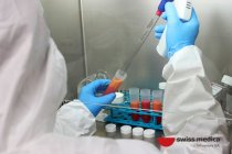 Cellule staminali trattamento con sclerosi multipla